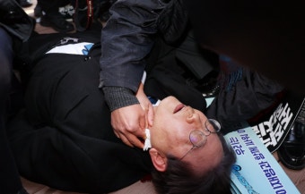권익위, 이재명 피습 헬기 이송 과정 조사 통보…천준호 