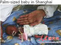 ‘힘겹게 내쉬는 숨’ 손바닥만한 中조산아