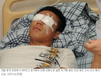 中프로축구 관중 난동으로 선수 실명 위기