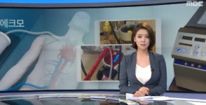 메르스 거점병원에 심폐장치 ‘에크모’ 전문 인력 지원