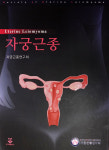 가톨릭대학교 서울성모병원 산부인과 김미란 교수, ‘자궁근종’ 발간