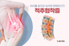 추운 날씨에 심해지는 척추협착증, 구부린 자세가 편하다고… [헬스토피아]
