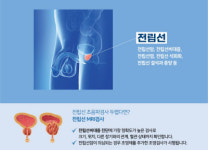 남성 노화 전립선비대증, 치료 방법은?