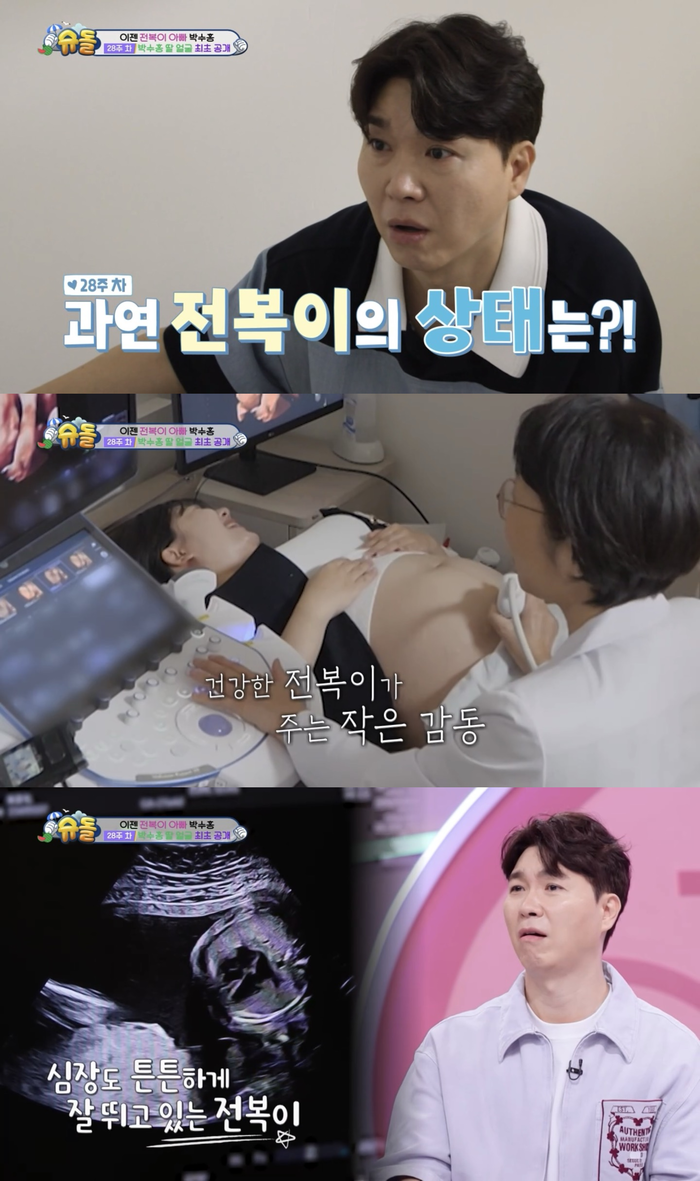 슈퍼맨이 돌아왔다 박수홍, 딸을 위한 무한한 애정 눈길