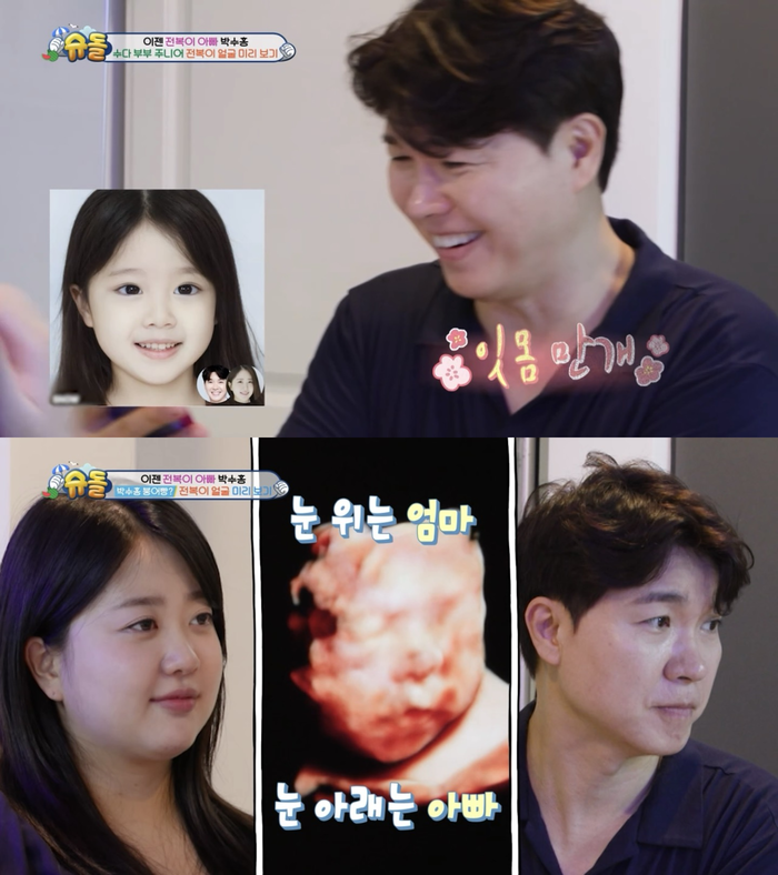 슈퍼맨이 돌아왔다 박수홍-김다예, 딸 전복이 출산 과정 공개로 감동 전해져