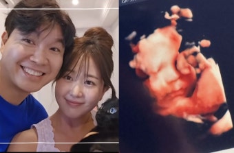 “모델 시켜야 해” 박수홍김다예, 출산 D-40 태아 사진 공개