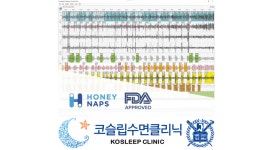 코슬립수면의원, 삼성전자·허니냅스와 수면 분석 기술 협력…솜눔 개발 중추 역할