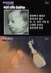 `효자` 남현이의 또다른 이름 `선천성 안면기형`