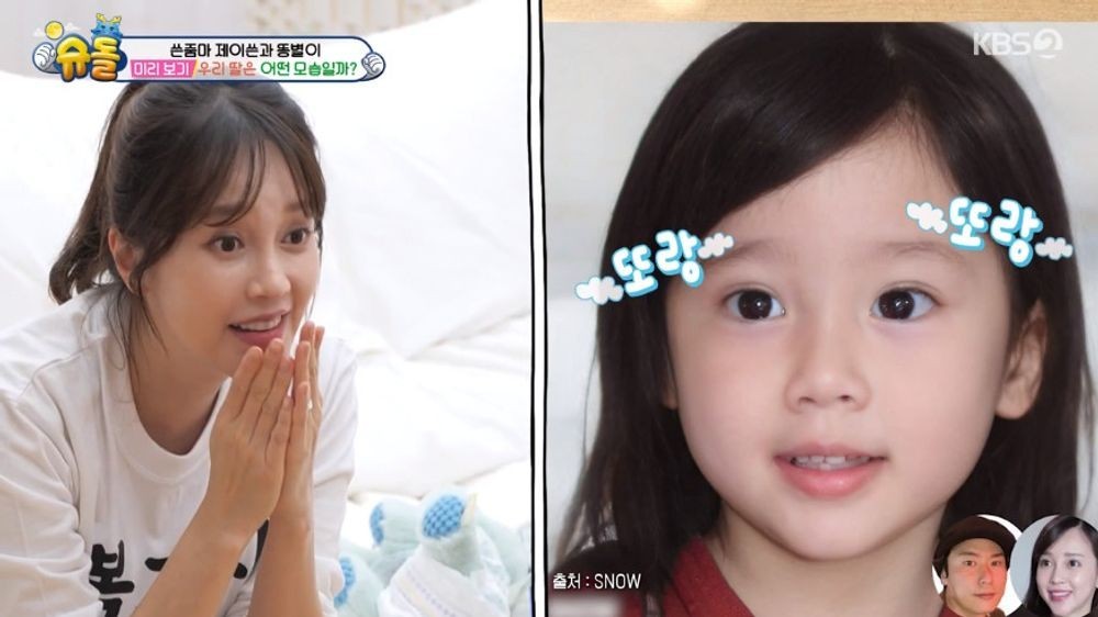 코미디언 오나미, 뇌혈관 문제로 안면 마비 경험 고백...2세 소망 간절히
