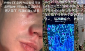 함소원, 중국인 남편 진화와 이혼 후 재결합 고민…가정폭력 의혹에 입 열 것