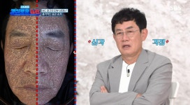 이경규, 피부 나이 결과에 '충격'... 