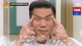 이채연, 3천모 모발 이식했다 