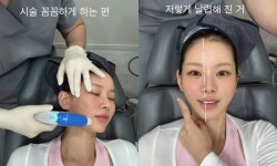'연속 성형 고백' 맹승지, 의사 남친 특권 누렸다…