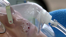 종합병원 중환자실 서비스 개선 양상…1등급 12개→ 64개로 증가