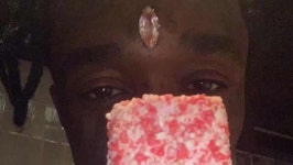 [World Now] 이마에 박은 277억 다이아…공연 중 팬이 잡아 뜯어