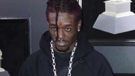 [World Now] 이마에 박은 277억 다이아…공연 중 팬이 잡아 뜯어