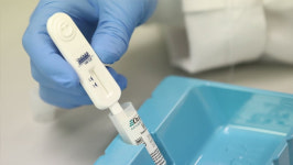 코로나 유행 이후, 인체면역결핍바이러스(HIV) 감염 신고 크게 감소
