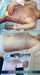 윤일병 사건, 참혹한 시신의 모습…군 당국 고의적 살인 아니다 논란 일파만파
