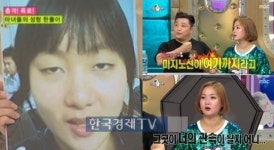 ‘라디오스타’ 박나래, “성형 더하면 관속에 누울지도”…과거 얼굴 어땠길래?