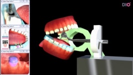 (주)디오, 바이오의료기기산업 핵심기술개발사업 주관기관 선정