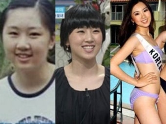 금나나도 못 피한 다이어트 굴레… 