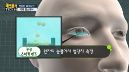 [테크본색] 미래 헬스케어_신비한 테크사전