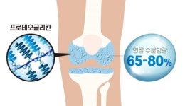 무릎 연골 손상되면 끝…관절도 수분 잘 챙겨야