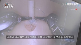 애플블러썸 다빈치병원점 | 수술 로봇계의 애플…대체 불가 '다빈치' 발명한 이 회사 [바이 아메리카]