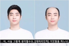 나는 남자다 30세 대머리 훈남...가발 사업으로 대박난 근황은?