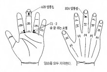 고려수지침학회 유태우회장이 전하는 코 알레르기 완화법