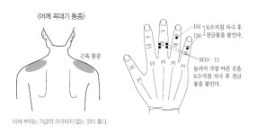 고려수지침학회가 전하는 어깨 근육 통증 완화