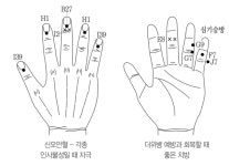 고려수지침학회가 전하는 더위병 증상 완화법