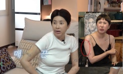 ‘코수술 5번’ 서인영,  팔뚝 지방흡입 고백 “워터밤 때문…출연료 다 썼다” (개과천선)