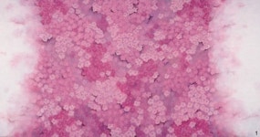 [갤러리 산책] Love Actually 展