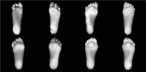 관악구청 발과 사람이야기 전시