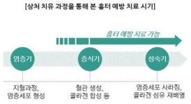 흉터 예방에도 골든타임 있다