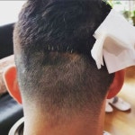 야만이 만든 상처…땅콩회항 피해자 박창진, 뒤통수 종양 제거 수술 경과 공개