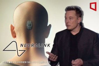 '머스크 표' 뇌칩 이식환자 문제 발생…