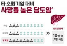 한국이 세계 발병률 2위…소리없이 찾아오는 담도암 [콕!건강]