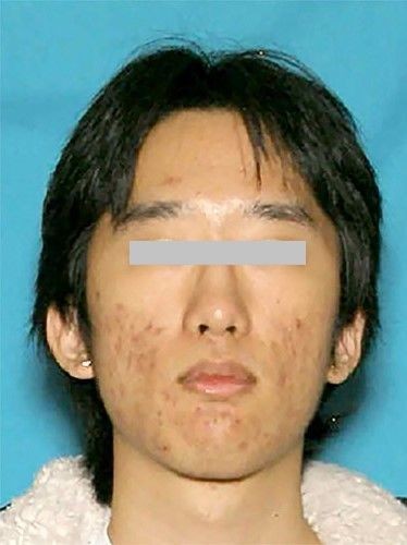 미국 캘리포니아주 팜스프링스 난임 클리닉 폭발 테러 공범 박 종연 사망함