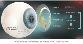 [K렌즈 성장기]③ 꿈의 렌즈 향해… 인터로조, 기술 혁신 총력