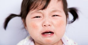 아토피피부염은 불치병이 아니다