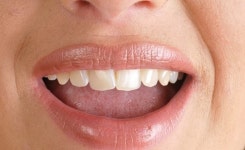 양치도 잘 했는데... 아침에 입냄새 나는 이유