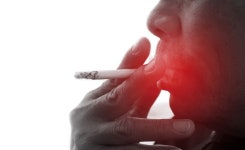 흡연 남성은 2배, 여성은 3배 높은 구강암