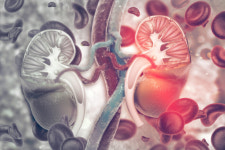 심장 혈관에 칼슘 쌓이면 만성 콩팥병 진행 빨라져