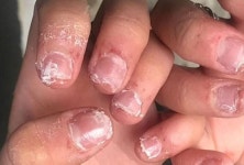 젤 네일이 ‘알레르기’ 유발...? 올바른 관리법은