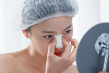 코 성형 후 코끝이 들렸어요...엉덩이 진피 넣었다는데, 왜?