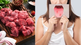 햄 고기 많이 먹었더니...대장암 말고도 이 암 위험?