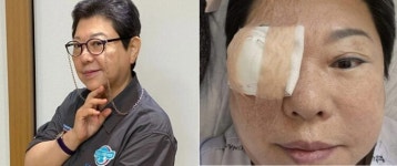 양희은, 각막이식 수술 근황…“아파야만 쉬는 여자인가”