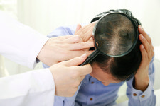 50대 이상, 머리부터 발끝까지 생기는 ‘백선증’